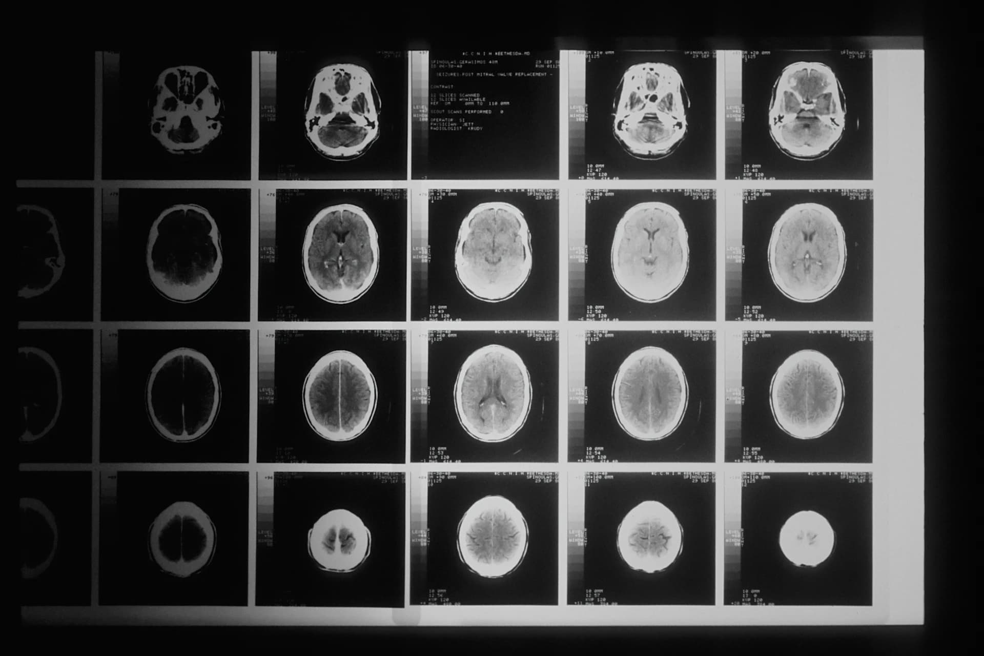 A series of cranial images on a viewing panel.