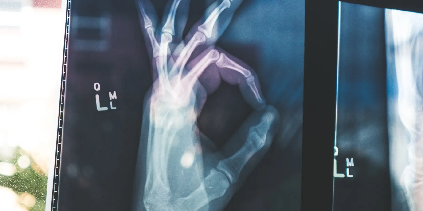 A diagnostic image displayed on a review screen.