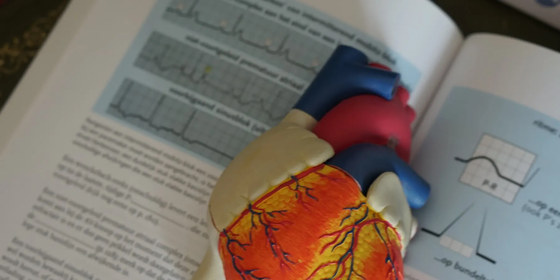 An anatomical heart model resting on a page of rhythm strips.