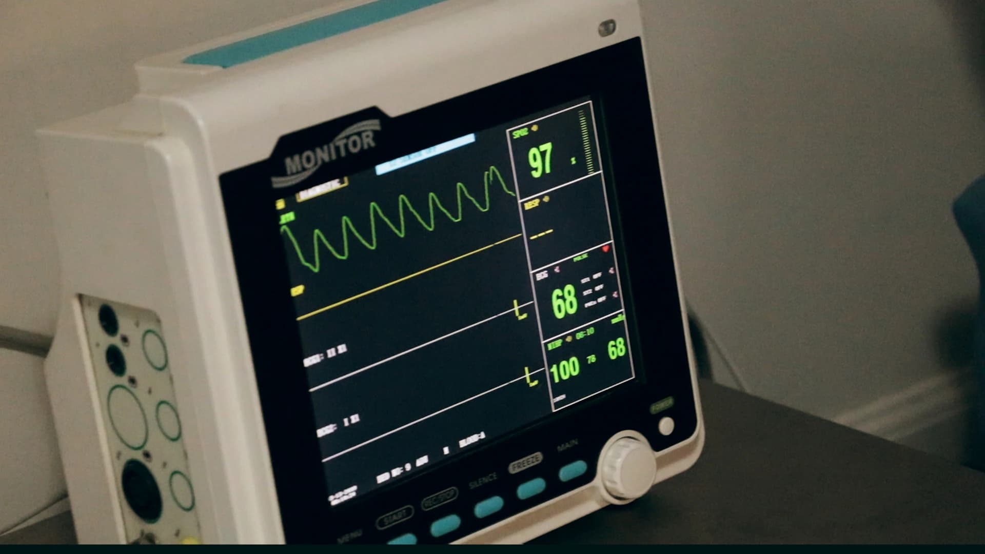 A bedside monitor tracing a rhythm in a cardiac unit.