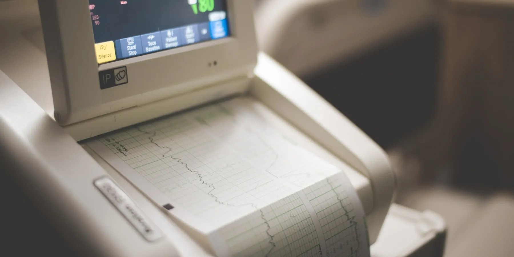 A bedside monitor beside its printed paper trace.