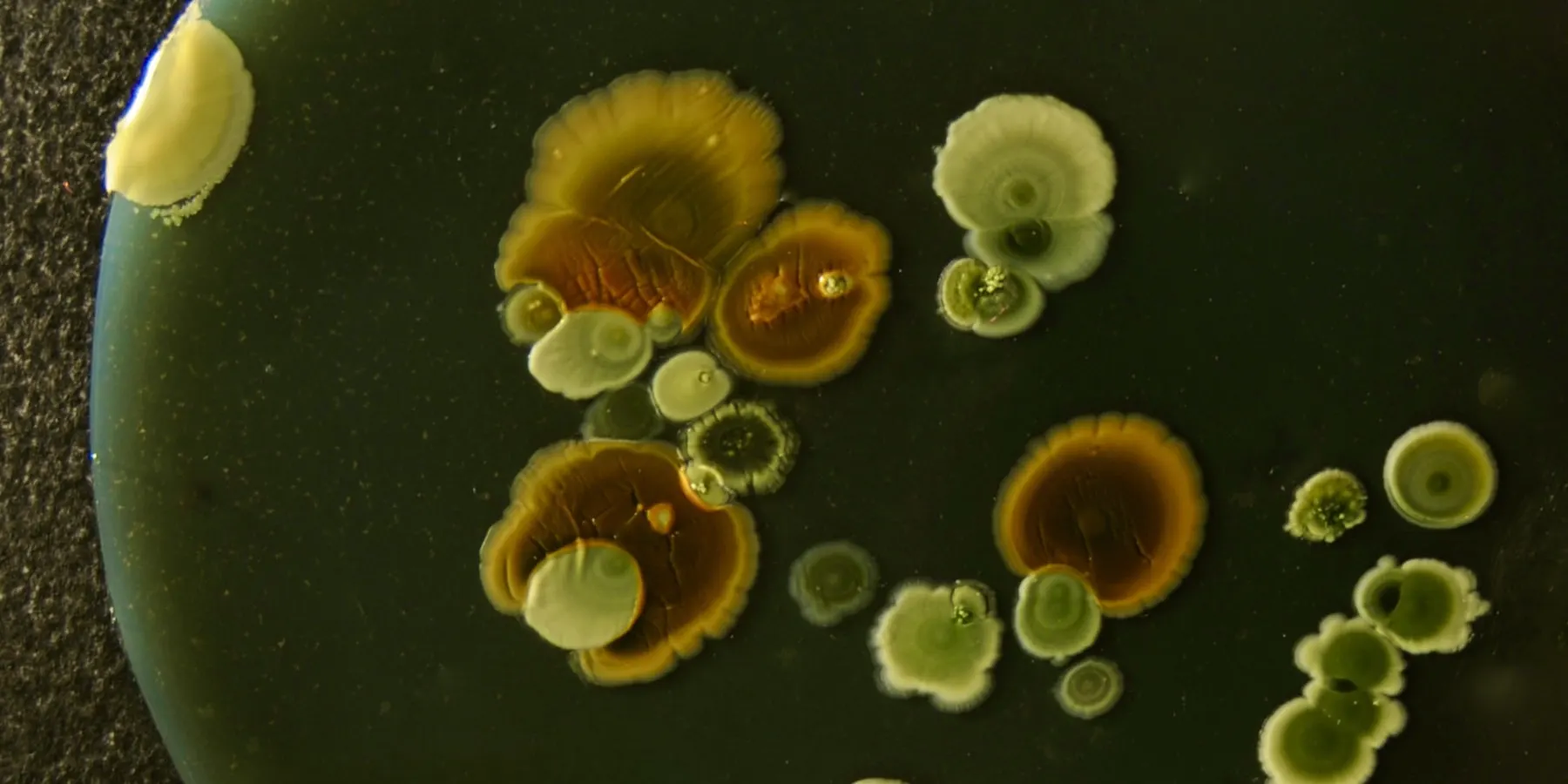 Bacterial colonies growing on a culture plate.