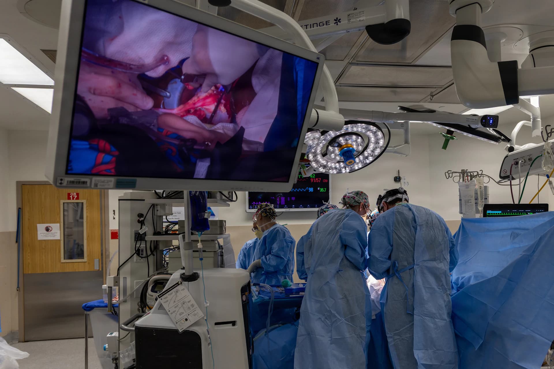 A procedure under way, followed on a large screen.